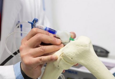 3D Printed Object for Medical Science 3D Printed Object for Medical Science