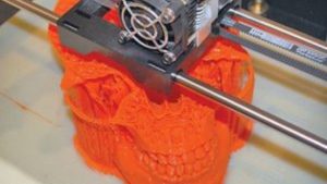 Skull Surgery: Future of 3d Printing Is Here